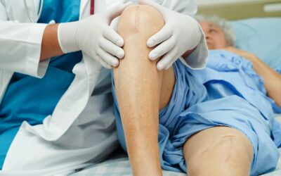 How to Manage Post-Surgical Pain That Won’t Go Away